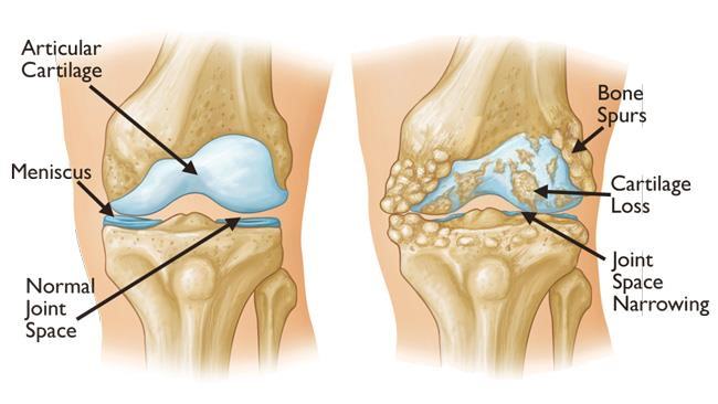 Knee Massage: Benefits and Tips